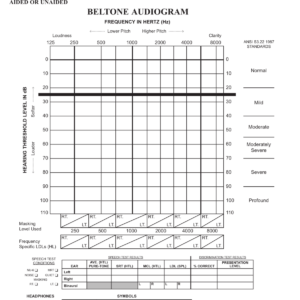 Beltone Audiogram